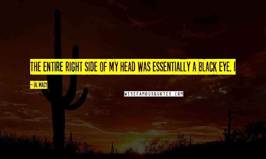 Al Macy Quotes: The entire right side of my head was essentially a black eye. I