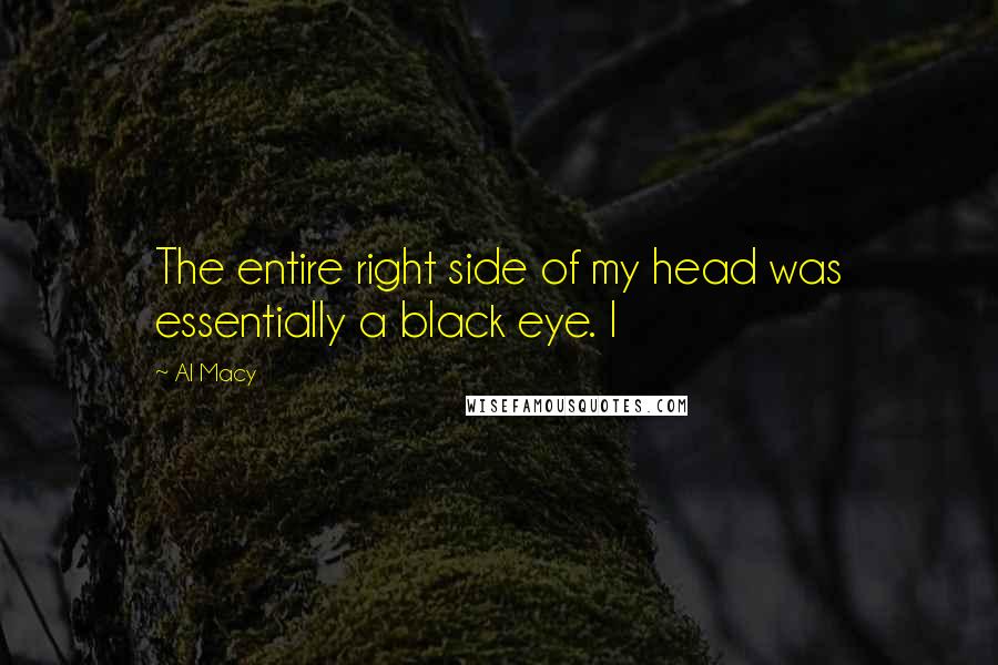 Al Macy Quotes: The entire right side of my head was essentially a black eye. I