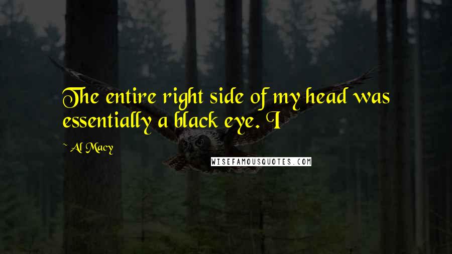 Al Macy Quotes: The entire right side of my head was essentially a black eye. I