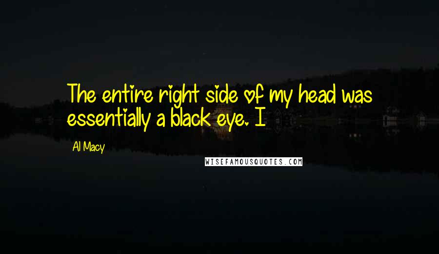 Al Macy Quotes: The entire right side of my head was essentially a black eye. I