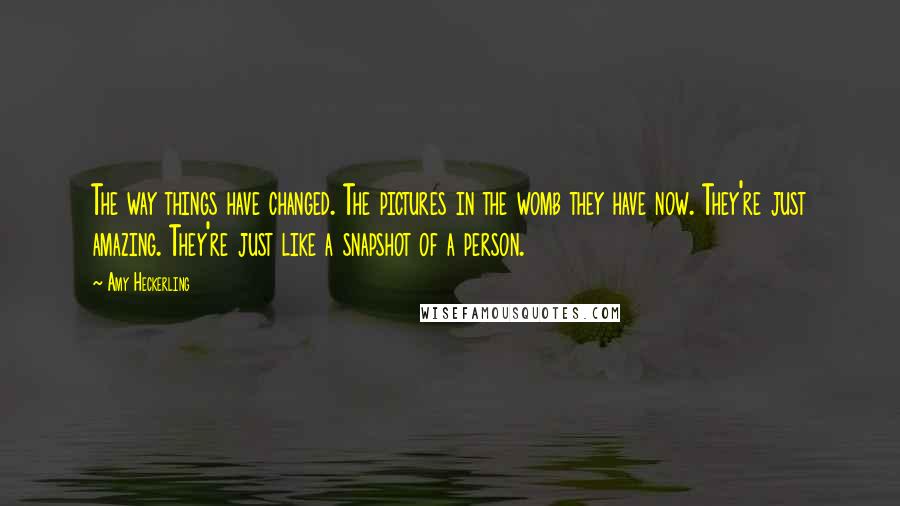 Amy Heckerling Quotes: The way things have changed. The pictures in the womb they have now. They're just amazing. They're just like a snapshot of a person.