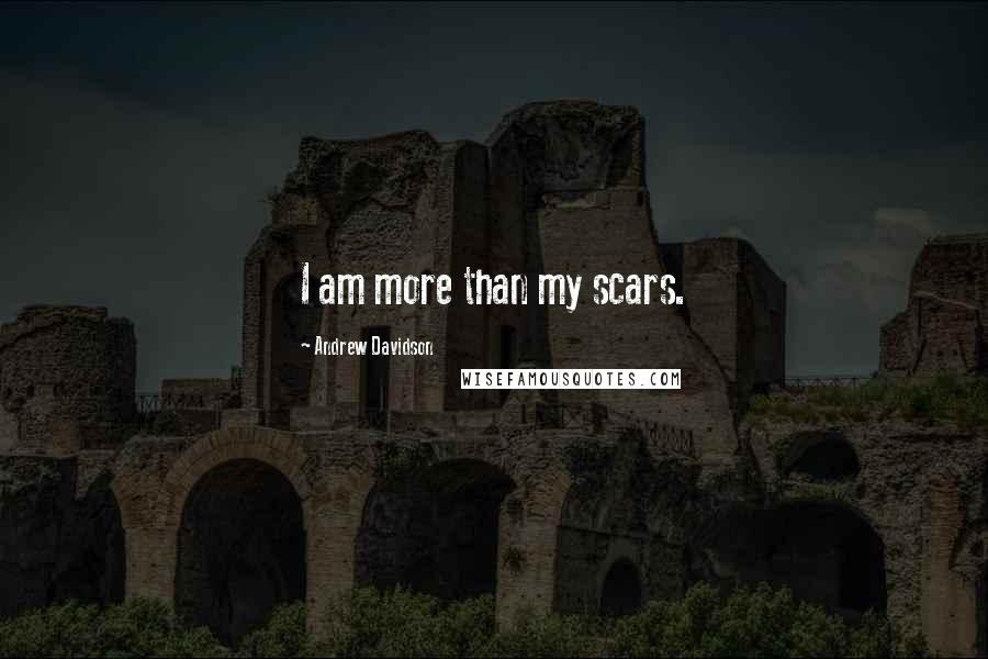 Andrew Davidson Quotes: I am more than my scars.