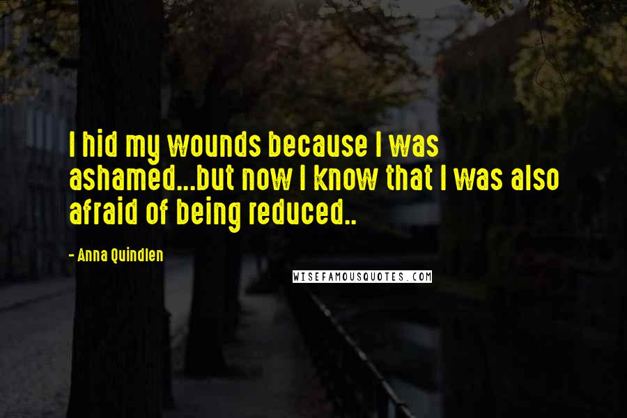 Anna Quindlen Quotes: I hid my wounds because I was ashamed...but now I know that I was also afraid of being reduced..