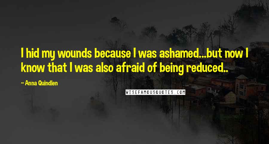 Anna Quindlen Quotes: I hid my wounds because I was ashamed...but now I know that I was also afraid of being reduced..