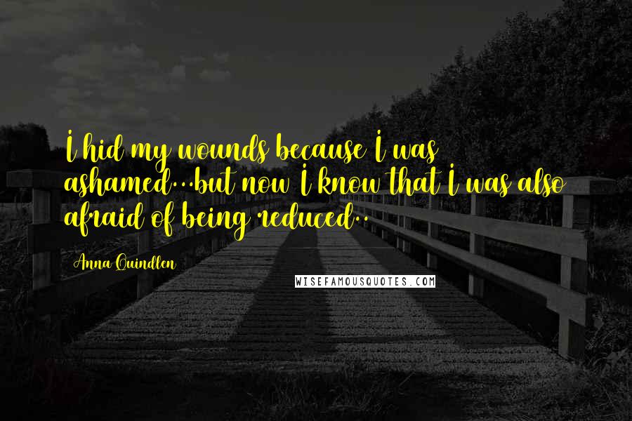 Anna Quindlen Quotes: I hid my wounds because I was ashamed...but now I know that I was also afraid of being reduced..