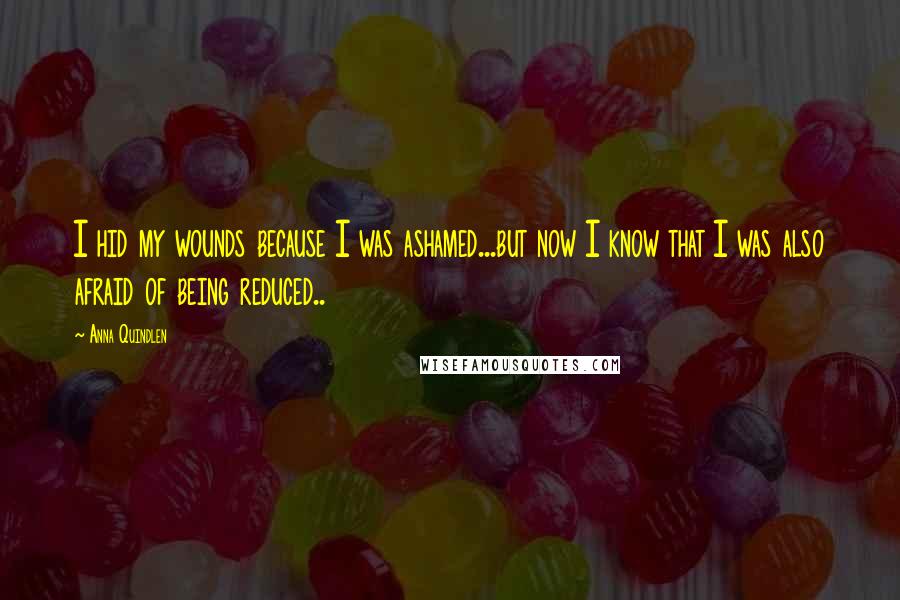 Anna Quindlen Quotes: I hid my wounds because I was ashamed...but now I know that I was also afraid of being reduced..