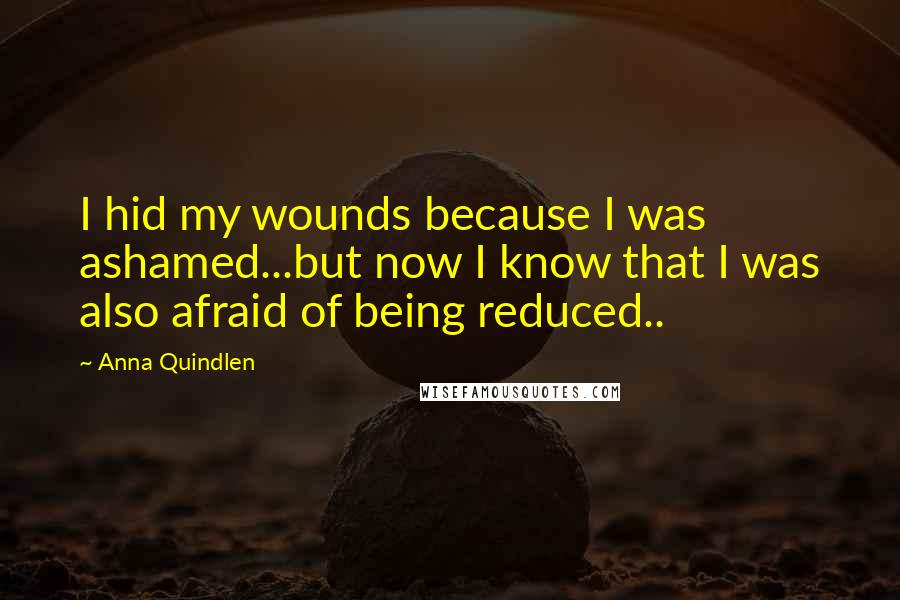 Anna Quindlen Quotes: I hid my wounds because I was ashamed...but now I know that I was also afraid of being reduced..