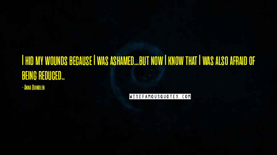 Anna Quindlen Quotes: I hid my wounds because I was ashamed...but now I know that I was also afraid of being reduced..