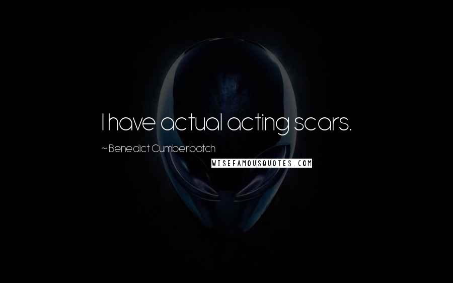 Benedict Cumberbatch Quotes: I have actual acting scars.
