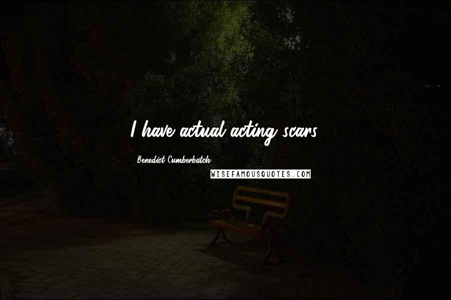 Benedict Cumberbatch Quotes: I have actual acting scars.