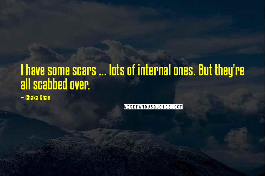 Chaka Khan Quotes: I have some scars ... lots of internal ones. But they're all scabbed over.