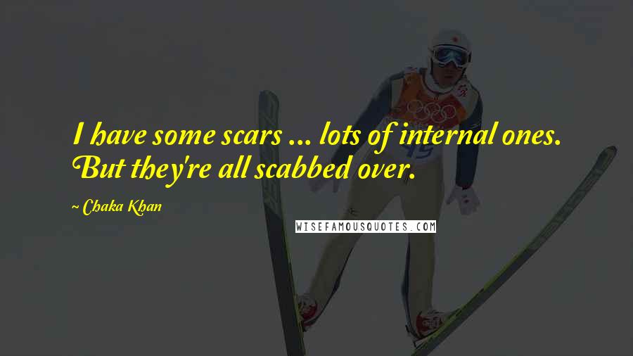 Chaka Khan Quotes: I have some scars ... lots of internal ones. But they're all scabbed over.