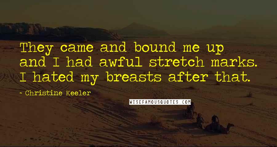 Christine Keeler Quotes: They came and bound me up and I had awful stretch marks. I hated my breasts after that.