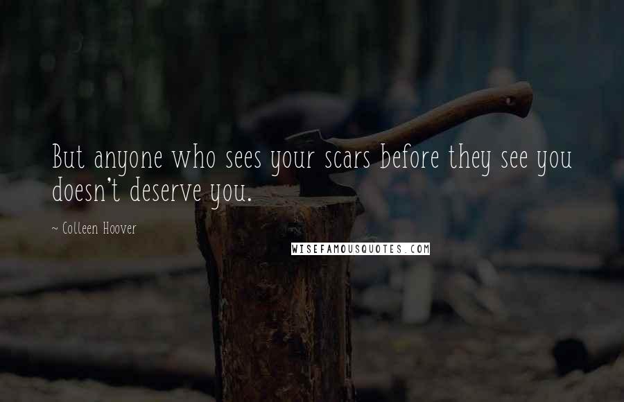 Colleen Hoover Quotes: But anyone who sees your scars before they see you doesn't deserve you.