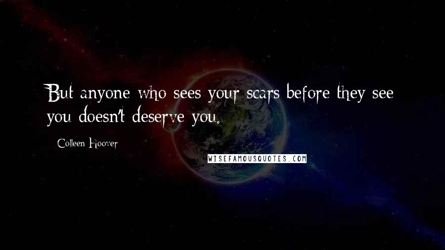 Colleen Hoover Quotes: But anyone who sees your scars before they see you doesn't deserve you.