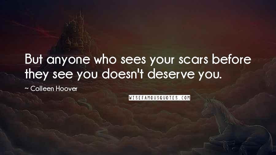 Colleen Hoover Quotes: But anyone who sees your scars before they see you doesn't deserve you.