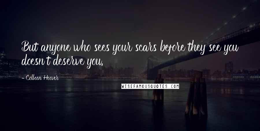 Colleen Hoover Quotes: But anyone who sees your scars before they see you doesn't deserve you.