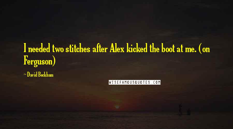 David Beckham Quotes: I needed two stitches after Alex kicked the boot at me. (on Ferguson)