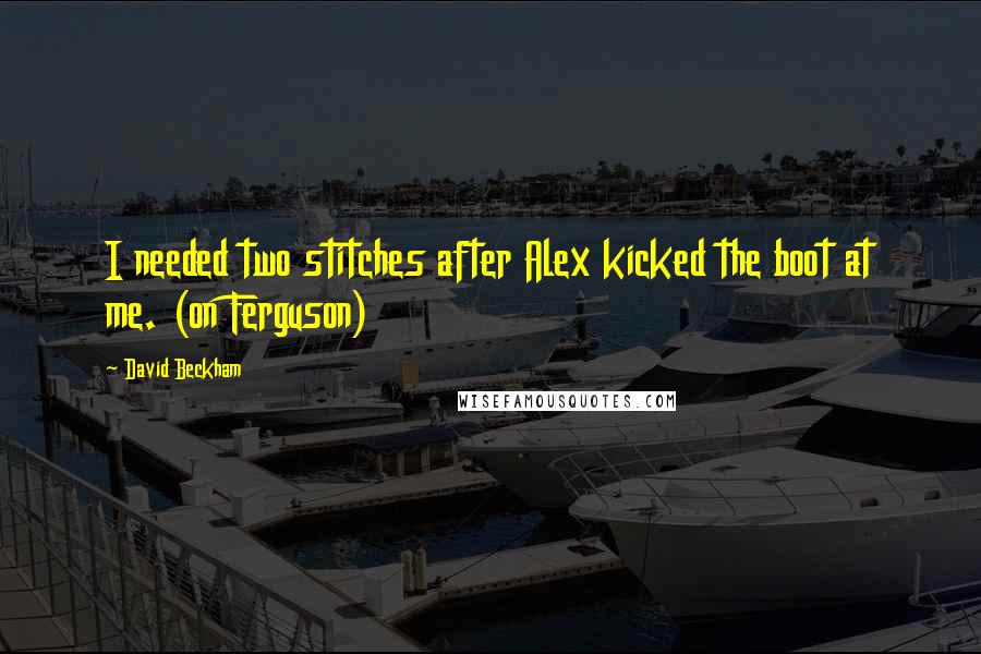 David Beckham Quotes: I needed two stitches after Alex kicked the boot at me. (on Ferguson)