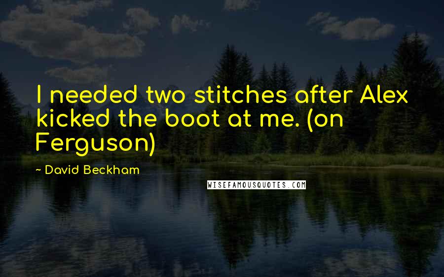 David Beckham Quotes: I needed two stitches after Alex kicked the boot at me. (on Ferguson)