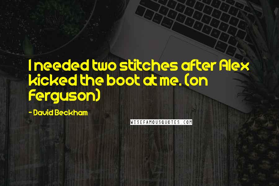 David Beckham Quotes: I needed two stitches after Alex kicked the boot at me. (on Ferguson)