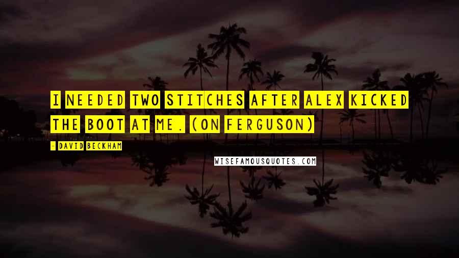 David Beckham Quotes: I needed two stitches after Alex kicked the boot at me. (on Ferguson)