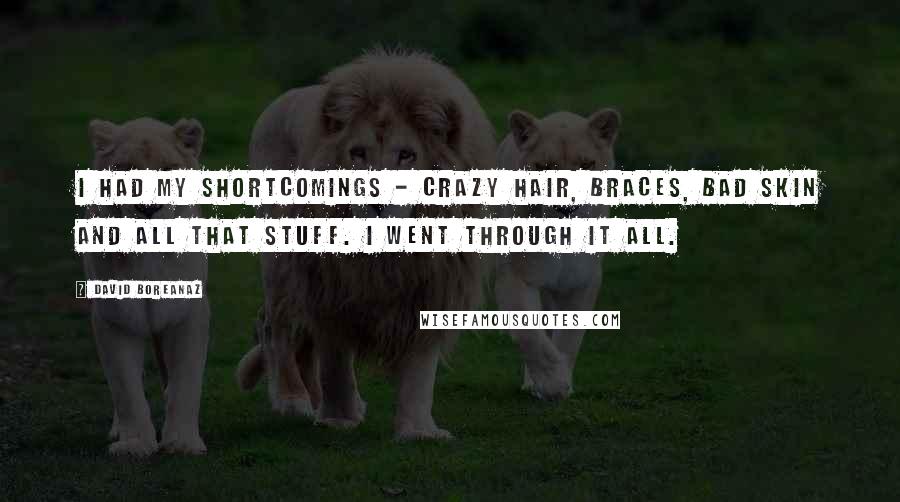 David Boreanaz Quotes: I had my shortcomings - crazy hair, braces, bad skin and all that stuff. I went through it all.