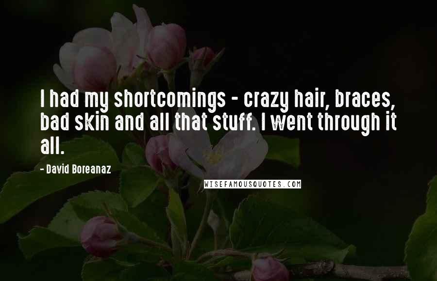 David Boreanaz Quotes: I had my shortcomings - crazy hair, braces, bad skin and all that stuff. I went through it all.