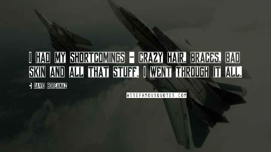 David Boreanaz Quotes: I had my shortcomings - crazy hair, braces, bad skin and all that stuff. I went through it all.