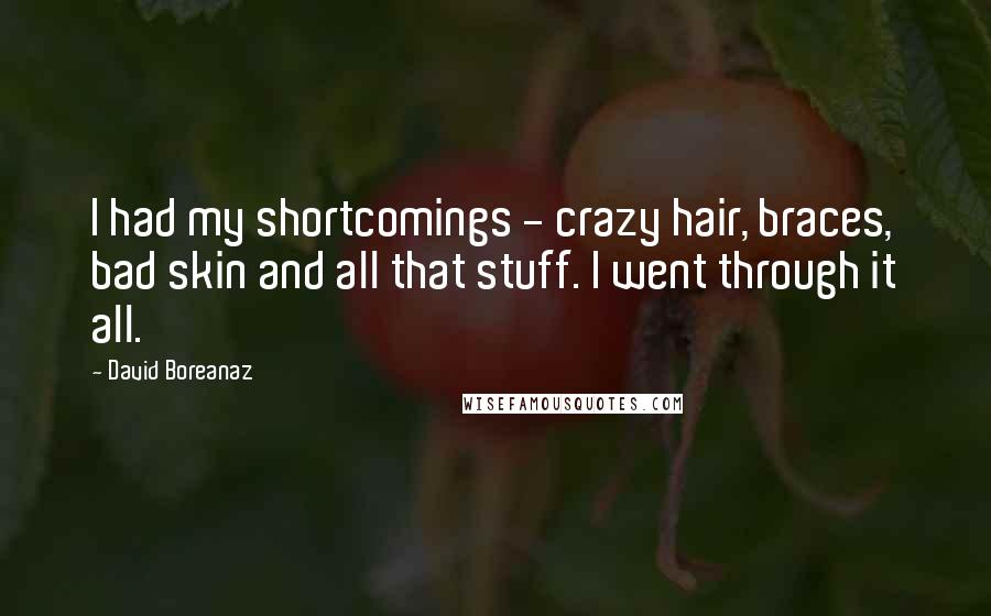 David Boreanaz Quotes: I had my shortcomings - crazy hair, braces, bad skin and all that stuff. I went through it all.