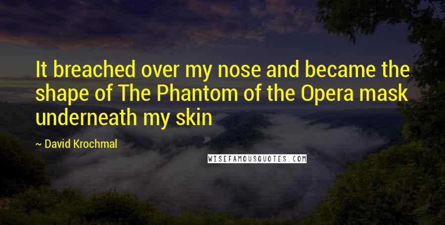 David Krochmal Quotes: It breached over my nose and became the shape of The Phantom of the Opera mask underneath my skin