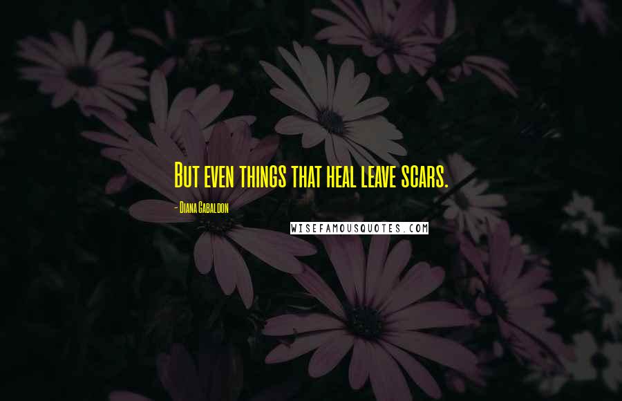 Diana Gabaldon Quotes: But even things that heal leave scars.