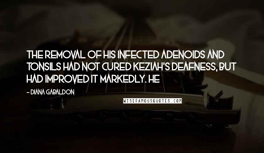 Diana Gabaldon Quotes: The removal of his infected adenoids and tonsils had not cured Keziah's deafness, but had improved it markedly. He