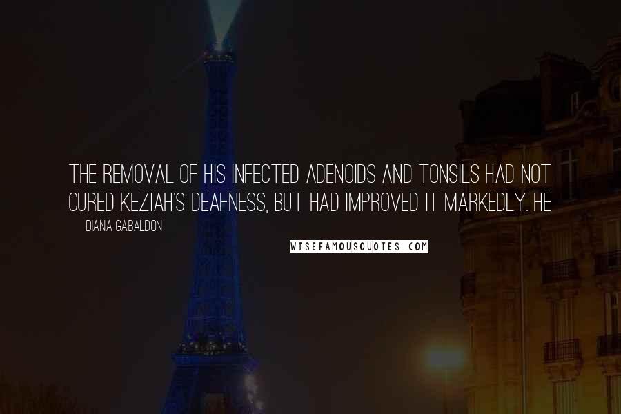 Diana Gabaldon Quotes: The removal of his infected adenoids and tonsils had not cured Keziah's deafness, but had improved it markedly. He