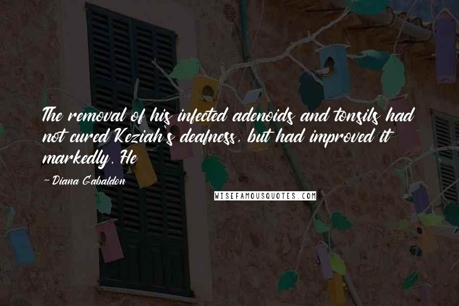 Diana Gabaldon Quotes: The removal of his infected adenoids and tonsils had not cured Keziah's deafness, but had improved it markedly. He