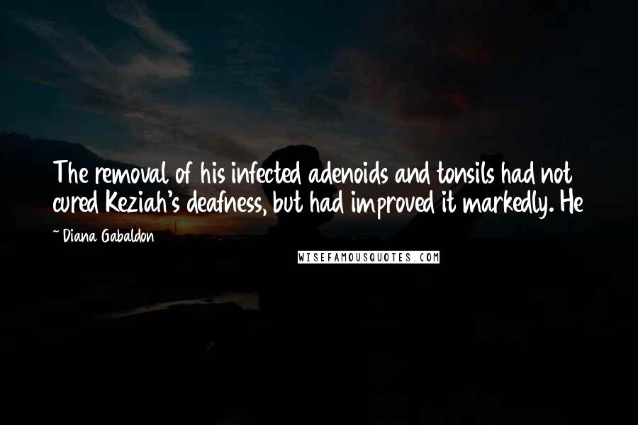 Diana Gabaldon Quotes: The removal of his infected adenoids and tonsils had not cured Keziah's deafness, but had improved it markedly. He