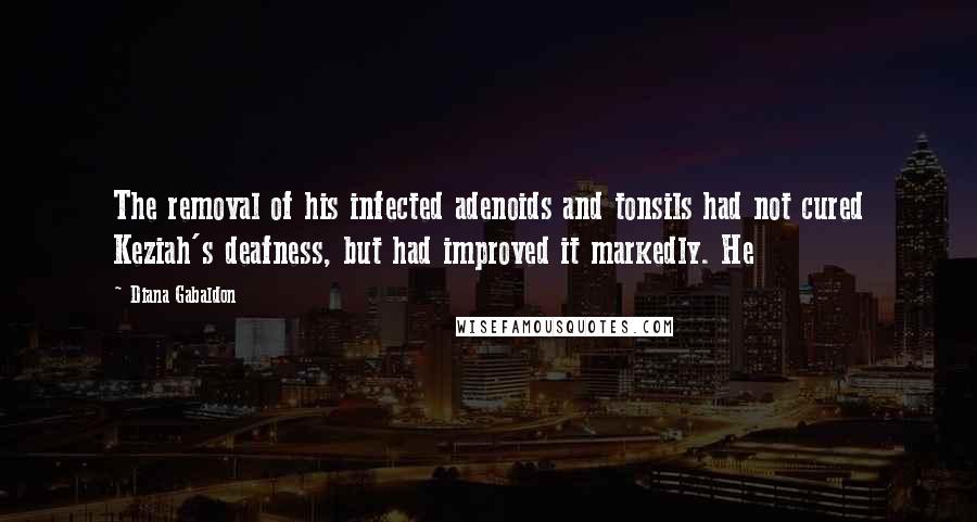Diana Gabaldon Quotes: The removal of his infected adenoids and tonsils had not cured Keziah's deafness, but had improved it markedly. He
