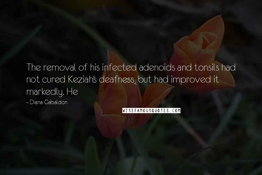 Diana Gabaldon Quotes: The removal of his infected adenoids and tonsils had not cured Keziah's deafness, but had improved it markedly. He