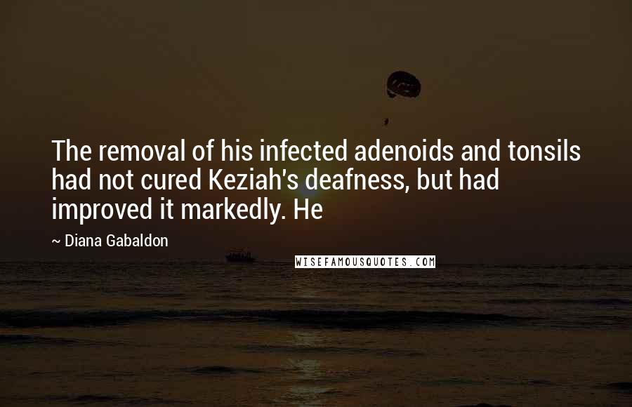 Diana Gabaldon Quotes: The removal of his infected adenoids and tonsils had not cured Keziah's deafness, but had improved it markedly. He
