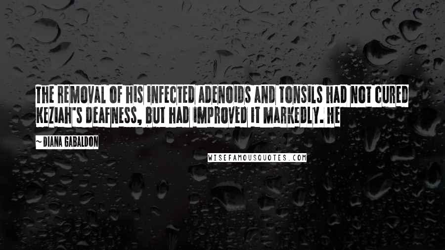 Diana Gabaldon Quotes: The removal of his infected adenoids and tonsils had not cured Keziah's deafness, but had improved it markedly. He