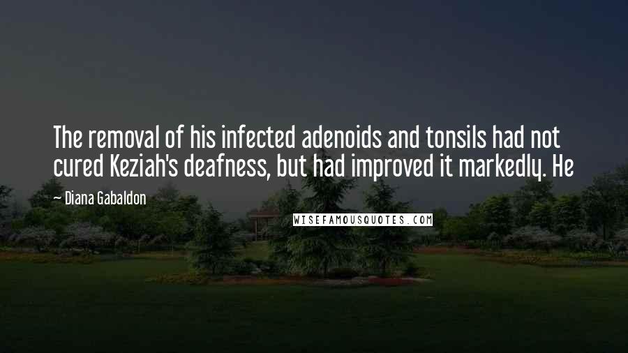 Diana Gabaldon Quotes: The removal of his infected adenoids and tonsils had not cured Keziah's deafness, but had improved it markedly. He