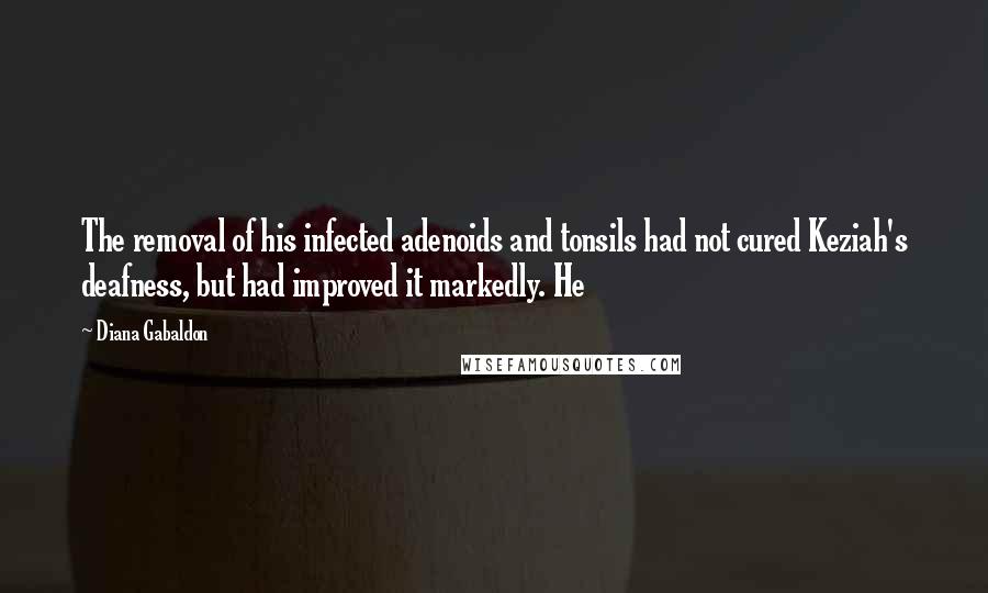 Diana Gabaldon Quotes: The removal of his infected adenoids and tonsils had not cured Keziah's deafness, but had improved it markedly. He