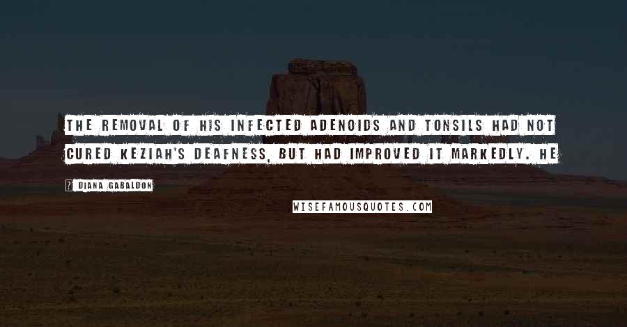 Diana Gabaldon Quotes: The removal of his infected adenoids and tonsils had not cured Keziah's deafness, but had improved it markedly. He