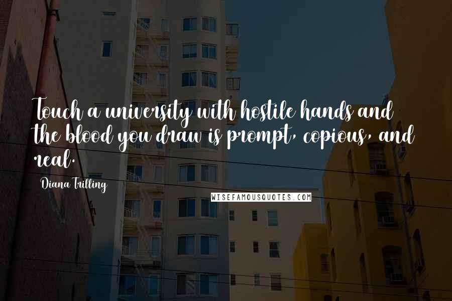 Diana Trilling Quotes: Touch a university with hostile hands and the blood you draw is prompt, copious, and real.