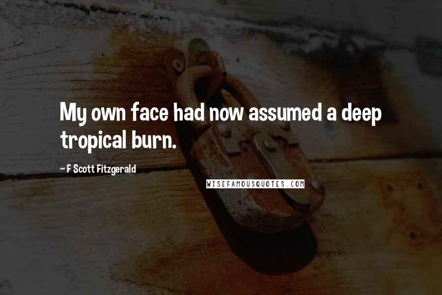 F Scott Fitzgerald Quotes: My own face had now assumed a deep tropical burn.