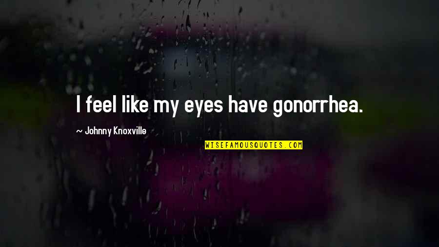 Activos Corrientes Quotes By Johnny Knoxville: I feel like my eyes have gonorrhea.
