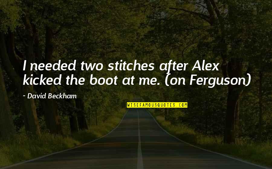 Alex Ferguson Quotes By David Beckham: I needed two stitches after Alex kicked the