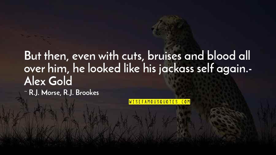 All Over Like Quotes By R.J. Morse, R.J. Brookes: But then, even with cuts, bruises and blood