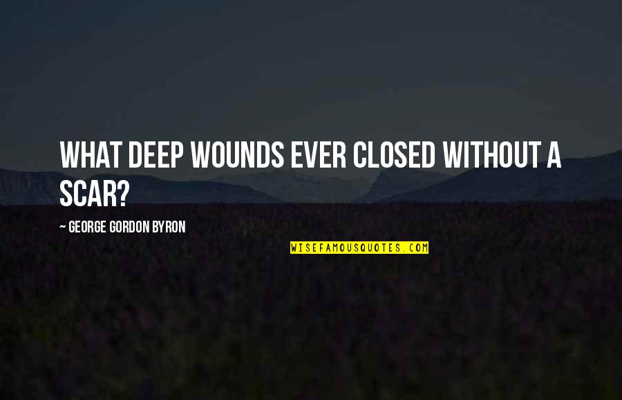 Amantes Pasajeros Quotes By George Gordon Byron: What deep wounds ever closed without a scar?