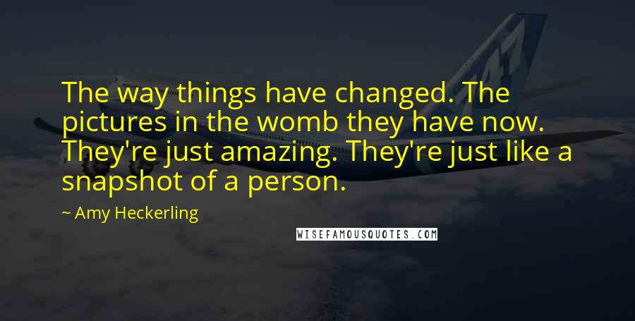 Amy Heckerling quotes: The way things have changed. The pictures in the womb they have now. They're just amazing. They're just like a snapshot of a person.